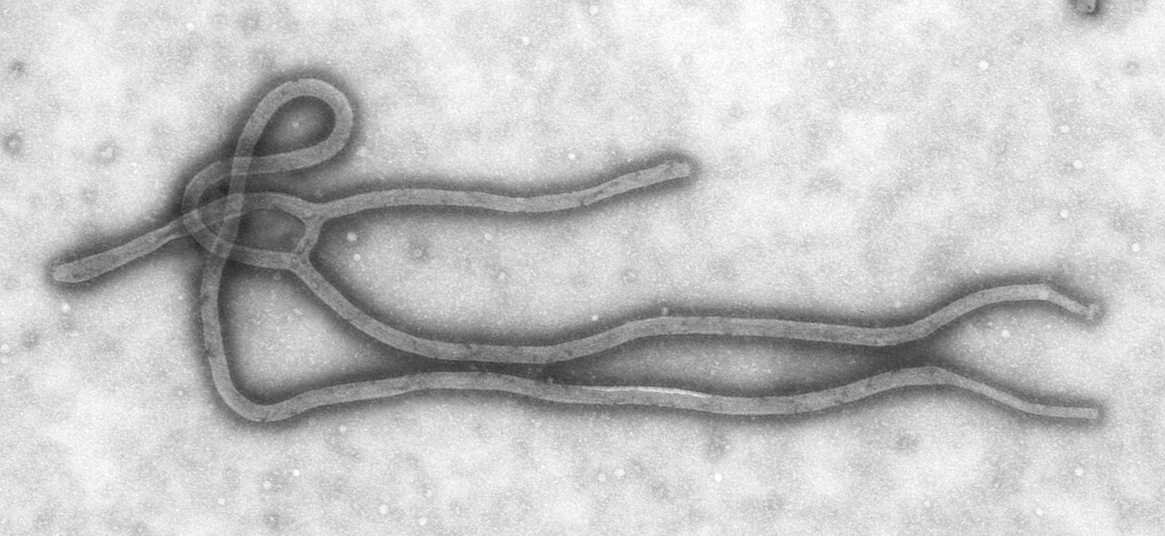 Virus Ebola observé au microscope électronique - CDC