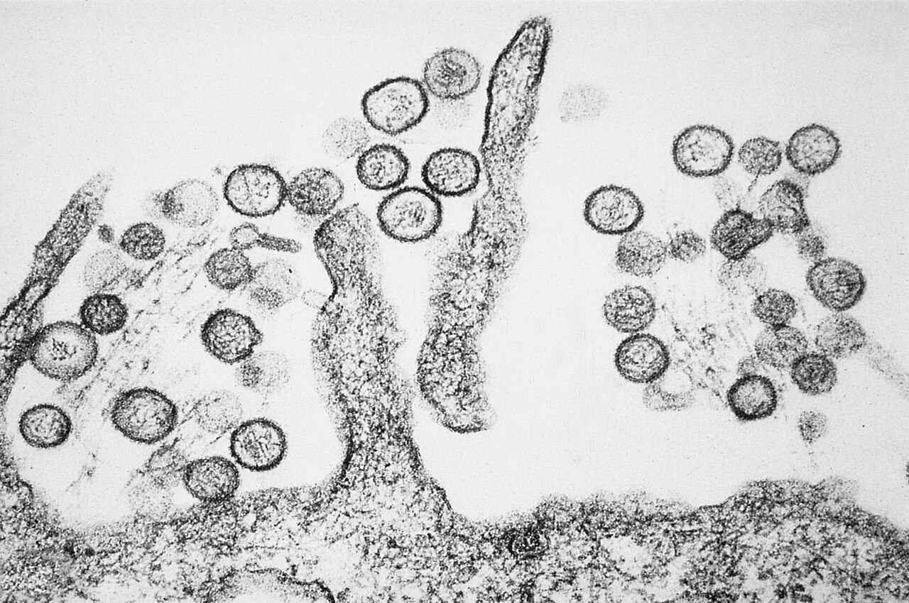 Particules virales de hantavirus observées au microscope électronique (CDC)